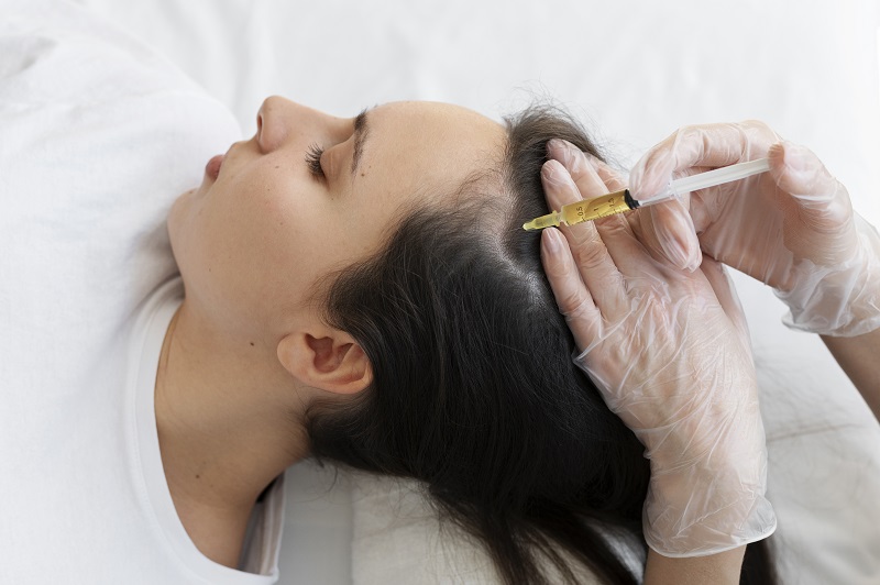 mindbody PRP Hair Restoration